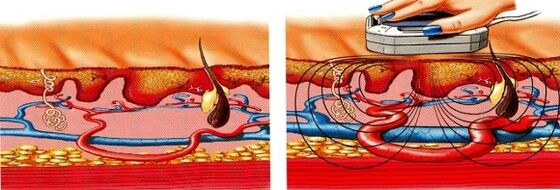 nëse këmbët tuaja mpihen